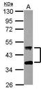 DnaJ Heat Shock Protein Family (Hsp40) Member A4 antibody, GTX118124, GeneTex, Western Blot image 