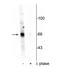 Akt antibody, NBP2-60772, Novus Biologicals, Western Blot image 