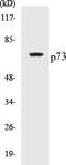 Tumor Protein P73 antibody, EKC1433, Boster Biological Technology, Western Blot image 