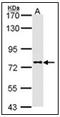 Dipeptidyl Peptidase 8 antibody, AP23624PU-N, Origene, Western Blot image 