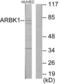 B1AR antibody, abx013440, Abbexa, Western Blot image 