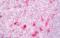Hepatocyte Growth Factor antibody, orb317633, Biorbyt, Immunohistochemistry paraffin image 