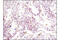 Phospholipase C Gamma 1 antibody, 5690P, Cell Signaling Technology, Immunohistochemistry paraffin image 