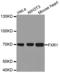 FMR1 Autosomal Homolog 1 antibody, A03308, Boster Biological Technology, Western Blot image 