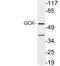Glucokinase antibody, LS-C199866, Lifespan Biosciences, Western Blot image 