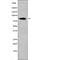 Arf-GAP with coiled-coil, ANK repeat and PH domain-containing protein 1 antibody, abx147905, Abbexa, Western Blot image 