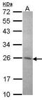 Syntaxin Binding Protein 6 antibody, PA5-28126, Invitrogen Antibodies, Western Blot image 