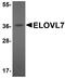 Elongation of very long chain fatty acids protein 7 antibody, A10141, Boster Biological Technology, Western Blot image 