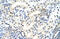 U1 small nuclear ribonucleoprotein 70 kDa antibody, ARP40276_T100, Aviva Systems Biology, Immunohistochemistry paraffin image 