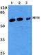 MutY DNA Glycosylase antibody, A01618Y176, Boster Biological Technology, Western Blot image 
