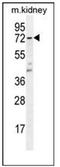 Thromboxane A Synthase 1 antibody, AP51174PU-N, Origene, Western Blot image 