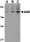 CD5 Molecule Like antibody, MBS151327, MyBioSource, Western Blot image 