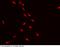 CREB2 antibody, 100842-T02, Sino Biological, Immunohistochemistry paraffin image 