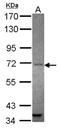 Angiomotin antibody, NBP2-15378, Novus Biologicals, Western Blot image 