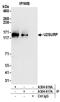 U2 SnRNP Associated SURP Domain Containing antibody, A304-616A, Bethyl Labs, Immunoprecipitation image 