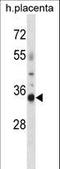 Olfactory Receptor Family 4 Subfamily K Member 13 antibody, LS-C163198, Lifespan Biosciences, Western Blot image 