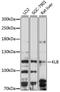 Klotho Beta antibody, 16-148, ProSci, Western Blot image 