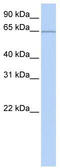 Pumilio RNA Binding Family Member 3 antibody, TA345757, Origene, Western Blot image 