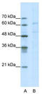 Calcium Voltage-Gated Channel Auxiliary Subunit Beta 3 antibody, TA338367, Origene, Western Blot image 