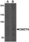 CCR4-NOT Transcription Complex Subunit 4 antibody, TA306651, Origene, Western Blot image 