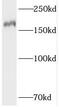 DNA topoisomerase 2-beta antibody, FNab08869, FineTest, Western Blot image 