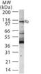 RB Transcriptional Corepressor 1 antibody, NB100-56888, Novus Biologicals, Western Blot image 