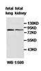 HLCS antibody, orb77697, Biorbyt, Western Blot image 