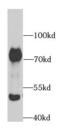 Acetylcholinesterase antibody, FNab00083, FineTest, Western Blot image 