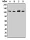 Poly(ADP-ribose) glycohydrolase antibody, LS-B16066, Lifespan Biosciences, Western Blot image 