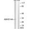 Abhydrolase Domain Containing 14A antibody, A16032, Boster Biological Technology, Western Blot image 