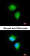 Metabolism Of Cobalamin Associated C antibody, orb69841, Biorbyt, Immunofluorescence image 