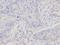 Junction Plakoglobin antibody, orb48937, Biorbyt, Immunohistochemistry paraffin image 