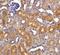 DNA Fragmentation Factor Subunit Beta antibody, A05374-2, Boster Biological Technology, Immunohistochemistry paraffin image 