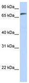 Armadillo Like Helical Domain Containing 4 antibody, TA335285, Origene, Western Blot image 