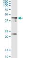 Centromere Protein J antibody, H00055835-M02, Novus Biologicals, Immunoprecipitation image 