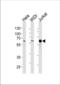 Histone Deacetylase 1 antibody, TA325167, Origene, Western Blot image 