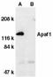 APAF antibody, ADI-905-179-100, Enzo Life Sciences, Western Blot image 