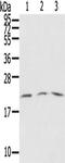 SSX Family Member 5 antibody, TA351758, Origene, Western Blot image 