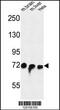 Striatin Interacting Protein 1 antibody, 64-079, ProSci, Western Blot image 