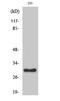 Ribosomal Protein L7 antibody, STJ95483, St John