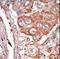 Fibroblast Growth Factor 4 antibody, LS-C101293, Lifespan Biosciences, Immunohistochemistry paraffin image 