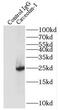 Caveolin 1 antibody, FNab01313, FineTest, Immunoprecipitation image 