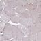 Insulin Like Growth Factor Binding Protein Acid Labile Subunit antibody, HPA040948, Atlas Antibodies, Immunohistochemistry frozen image 