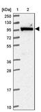 hMCS antibody, PA5-61632, Invitrogen Antibodies, Western Blot image 