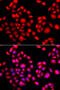 PR/SET Domain 14 antibody, 15-130, ProSci, Immunofluorescence image 