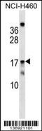 Mitochondrial Ribosomal Protein S11 antibody, 59-285, ProSci, Western Blot image 