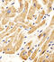Mothers against decapentaplegic homolog 1 antibody, MBS9212989, MyBioSource, Immunohistochemistry paraffin image 