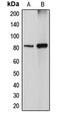 Diacylglycerol Kinase Alpha antibody, MBS820559, MyBioSource, Western Blot image 