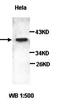Protein Kinase AMP-Activated Non-Catalytic Subunit Gamma 1 antibody, orb77068, Biorbyt, Western Blot image 
