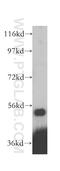 Phosphatidylinositol 4-Kinase Type 2 Beta antibody, 15074-1-AP, Proteintech Group, Western Blot image 